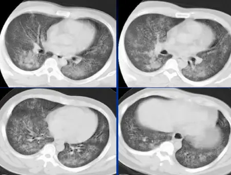 点击查看原图 图片
