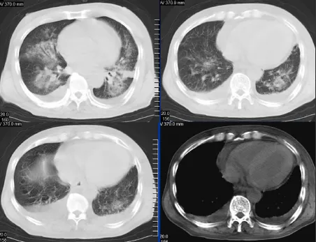 点击查看原图 图片