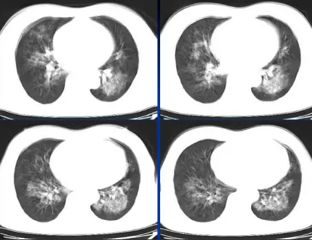 点击查看原图 图片