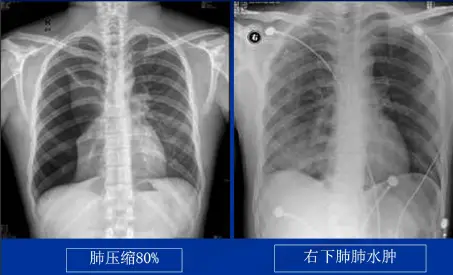 点击查看原图 图片