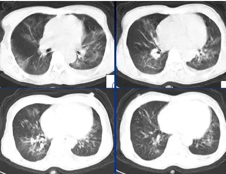 点击查看原图 图片