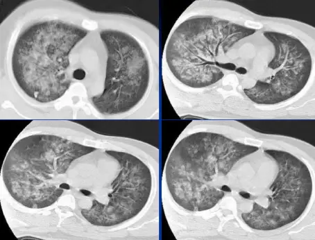 点击查看原图 图片