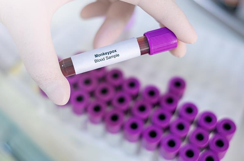 联合国儿基会发布招标紧急采购猴痘疫苗