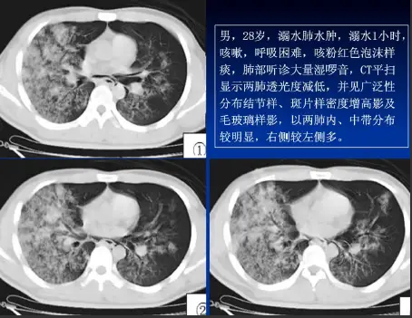 点击查看原图 图片
